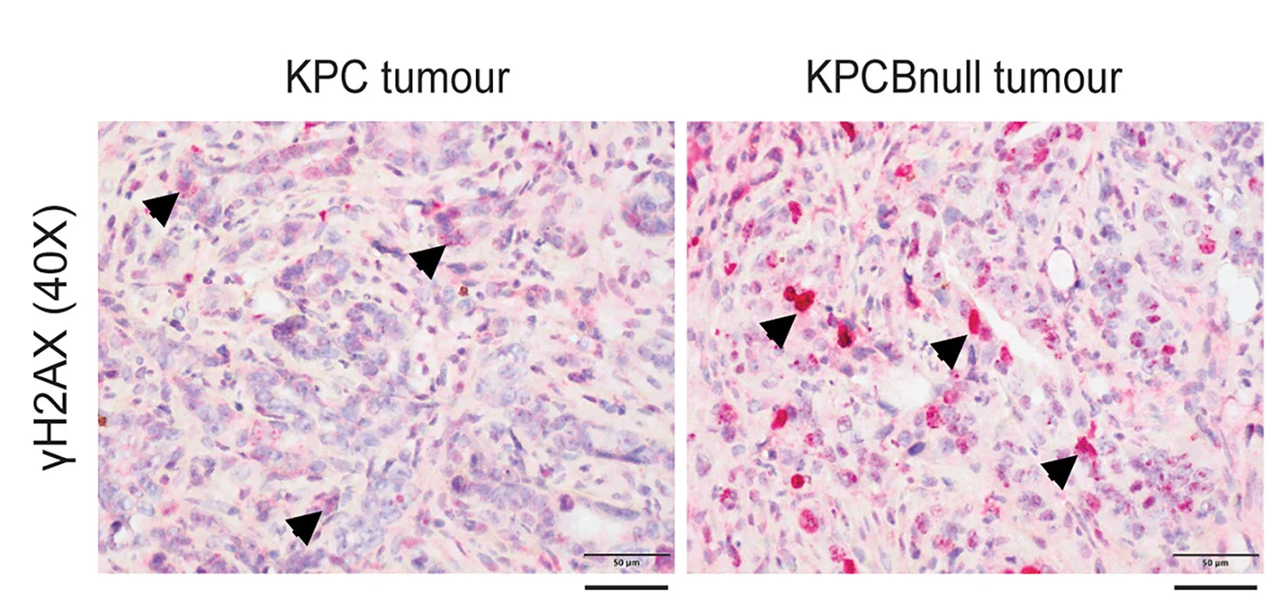 Open access visualization of Microscopy, GammaH2AX Immunostaining, KPC Tumors, KPCBnull Tumors, Representative Images