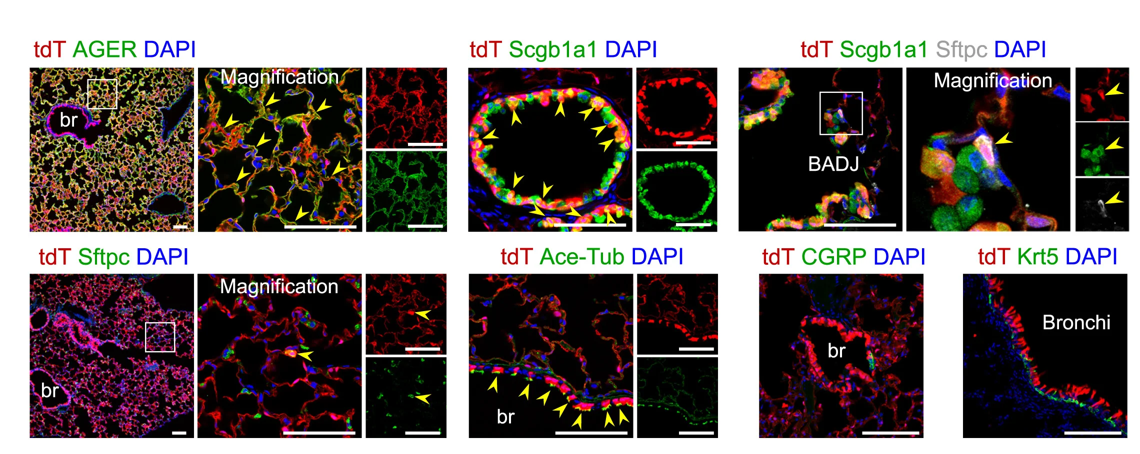 Open access visualization of Microscopy, Immunostaining, Lung Sections, tdT, AGER