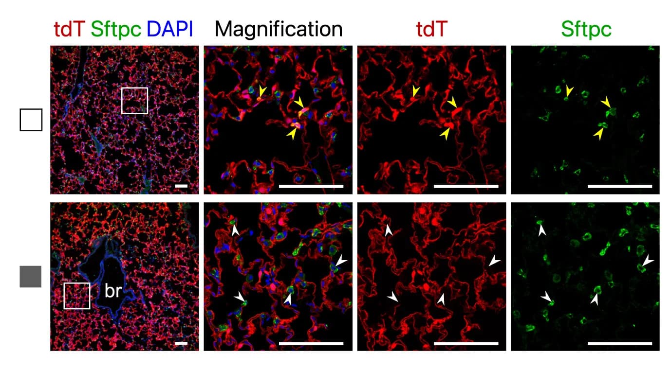 Open access visualization of Microscopy, Immunostaining, Lung Sections, PNX Injury, tdT