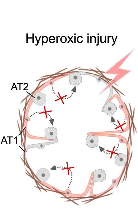 Open access visualization of Illustration, Workflow, AT1 Cells, AT2 Cells, Hyperoxia Injury