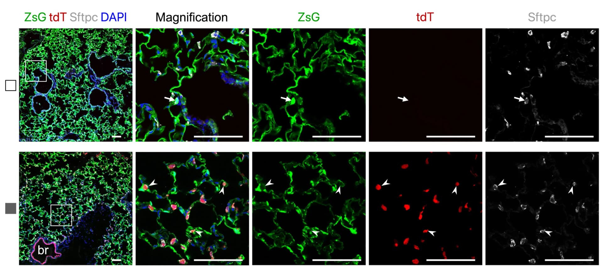 Open access visualization of Microscopy, Immunostaining, ZsG, tdT, Sftpc