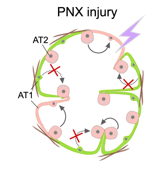 Open access visualization of Workflow, Illustration, Quantification, Sftpc+AT2 Cells, ZsG