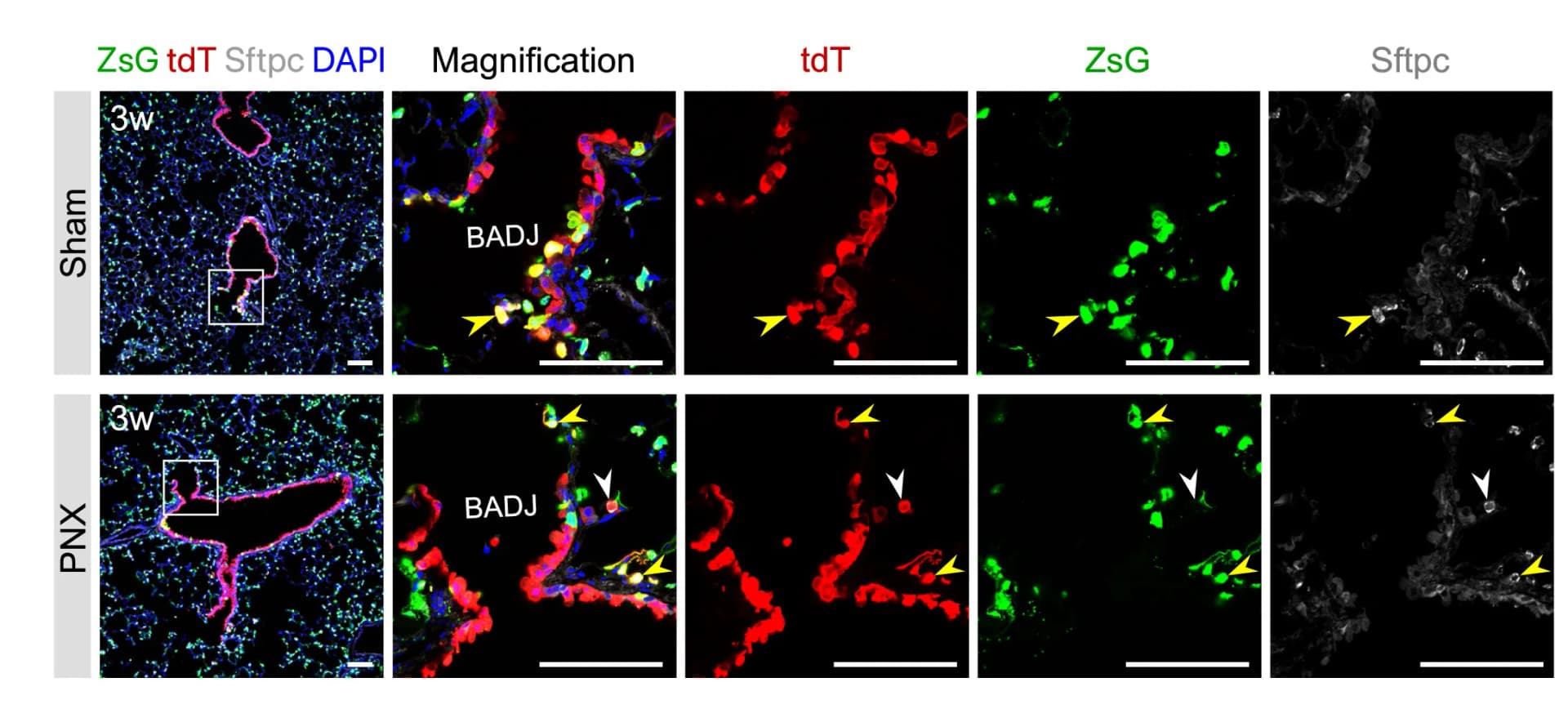 Open access visualization of Microscopy, Immunostaining, Lung Sections, ZsG, tdT