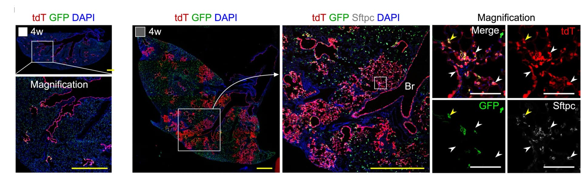 Open access visualization of Microscopy, Immunostaining, tdT, GFP, Sftpc