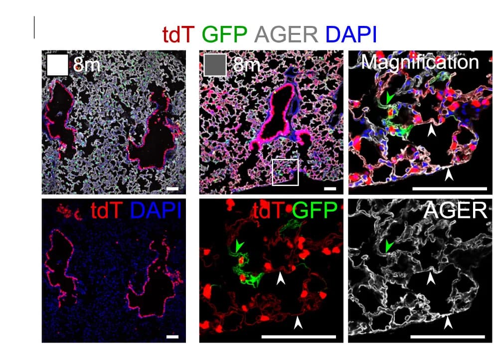 Open access visualization of Microscopy, Immunostaining, tdT, GFP, AGER