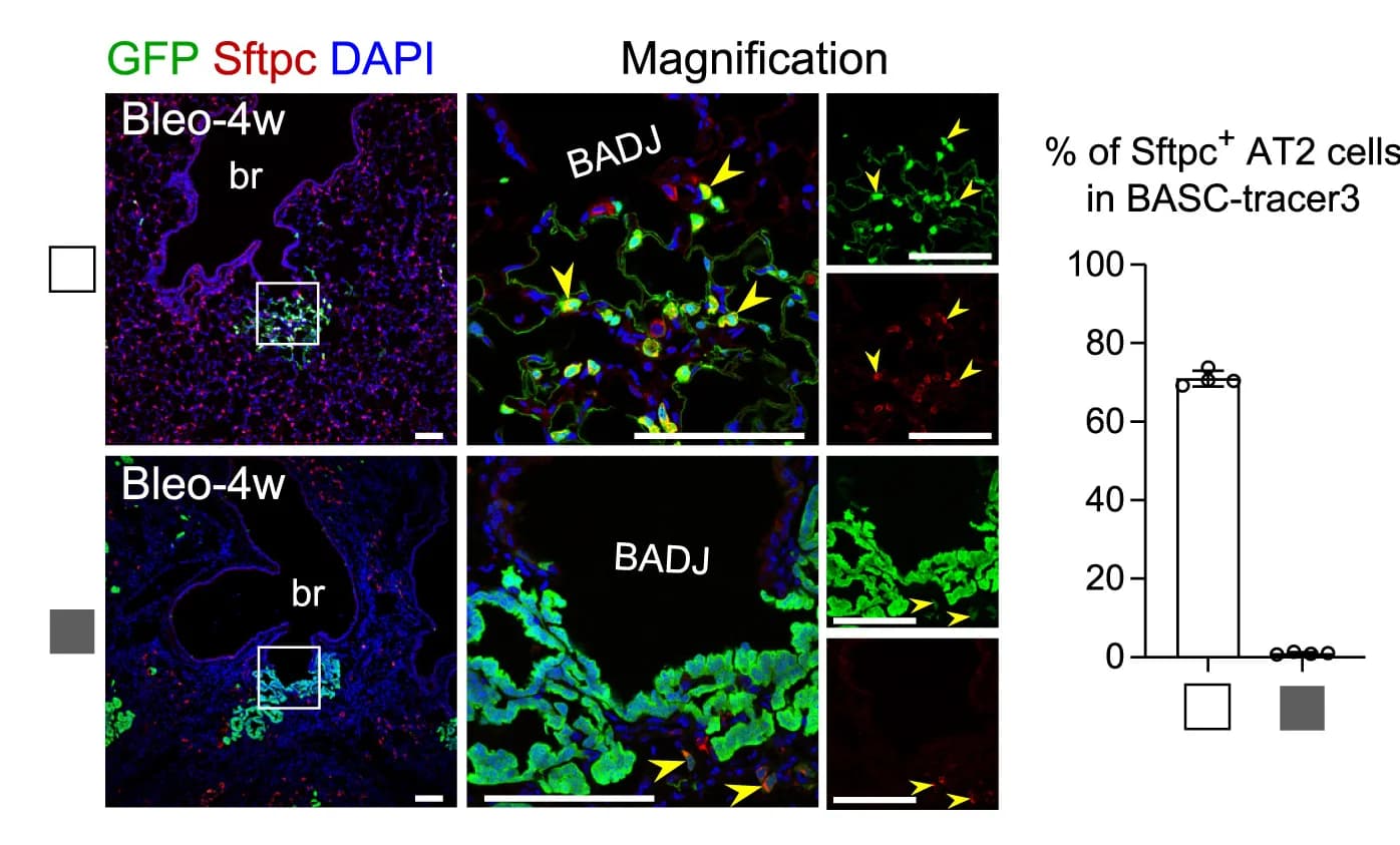 Open access visualization of Microscopy, Bar Plot, Immunostaining, GFP, Sftpc