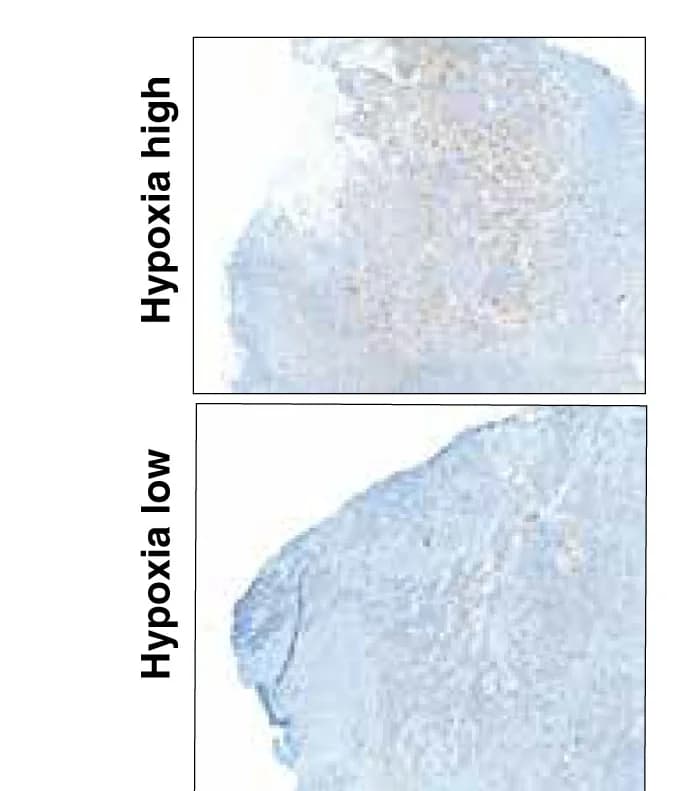 Open access visualization of Microscopy, Hypoxia, HIF-1 Staining