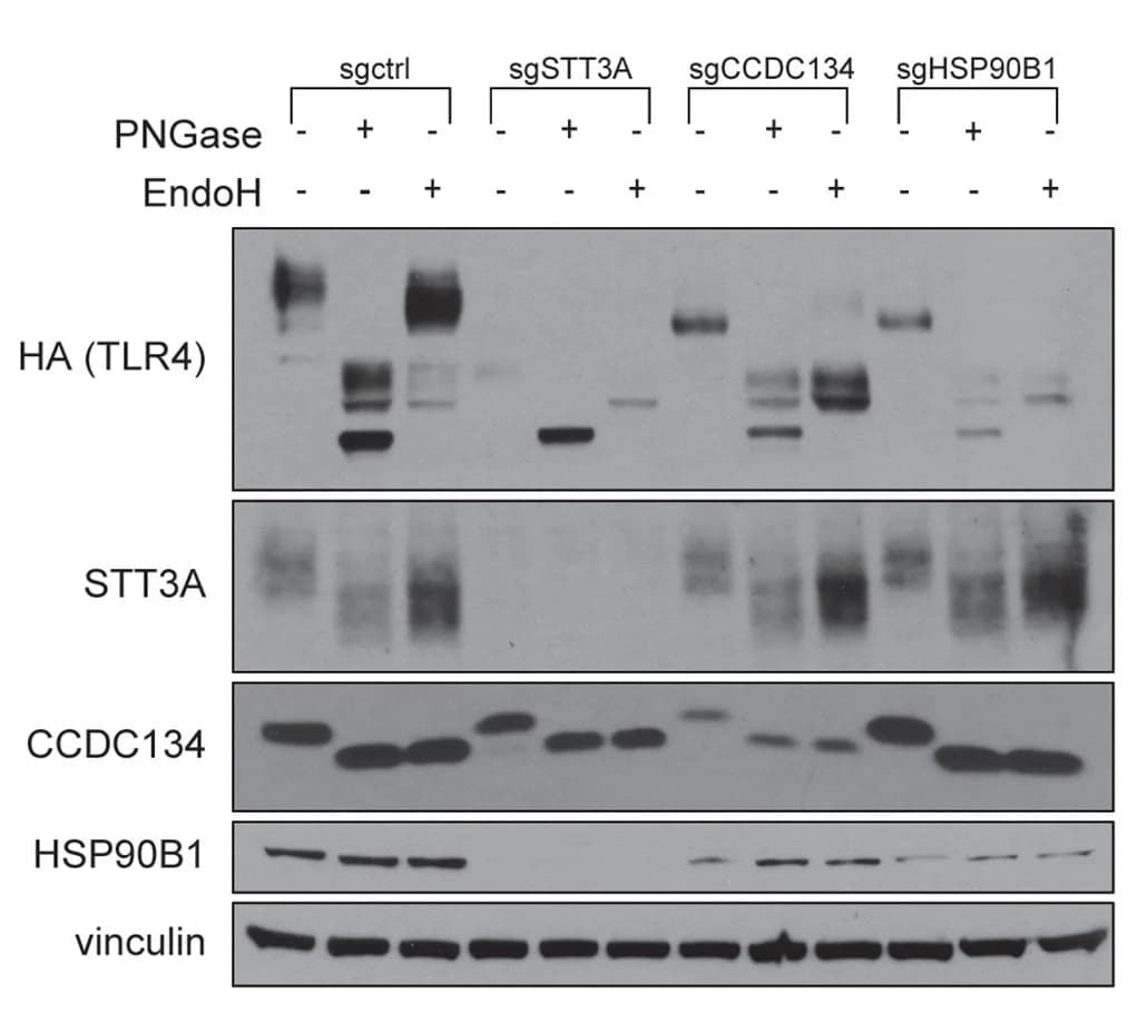 Open access visualization of Gel, Immunoblot Analysis, Cell Extracts, N-glycosidase PNGase F, PNGase