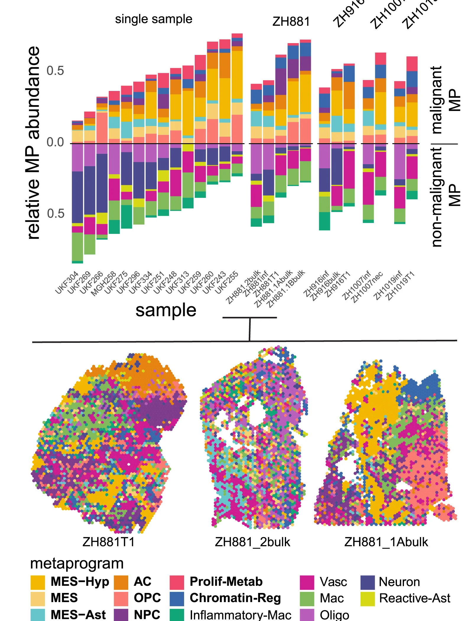 Open access visualization of Stacked Bar Plot, Scatter Plot, Sample, Metaprogram Proportions, Spatial Metaprograms