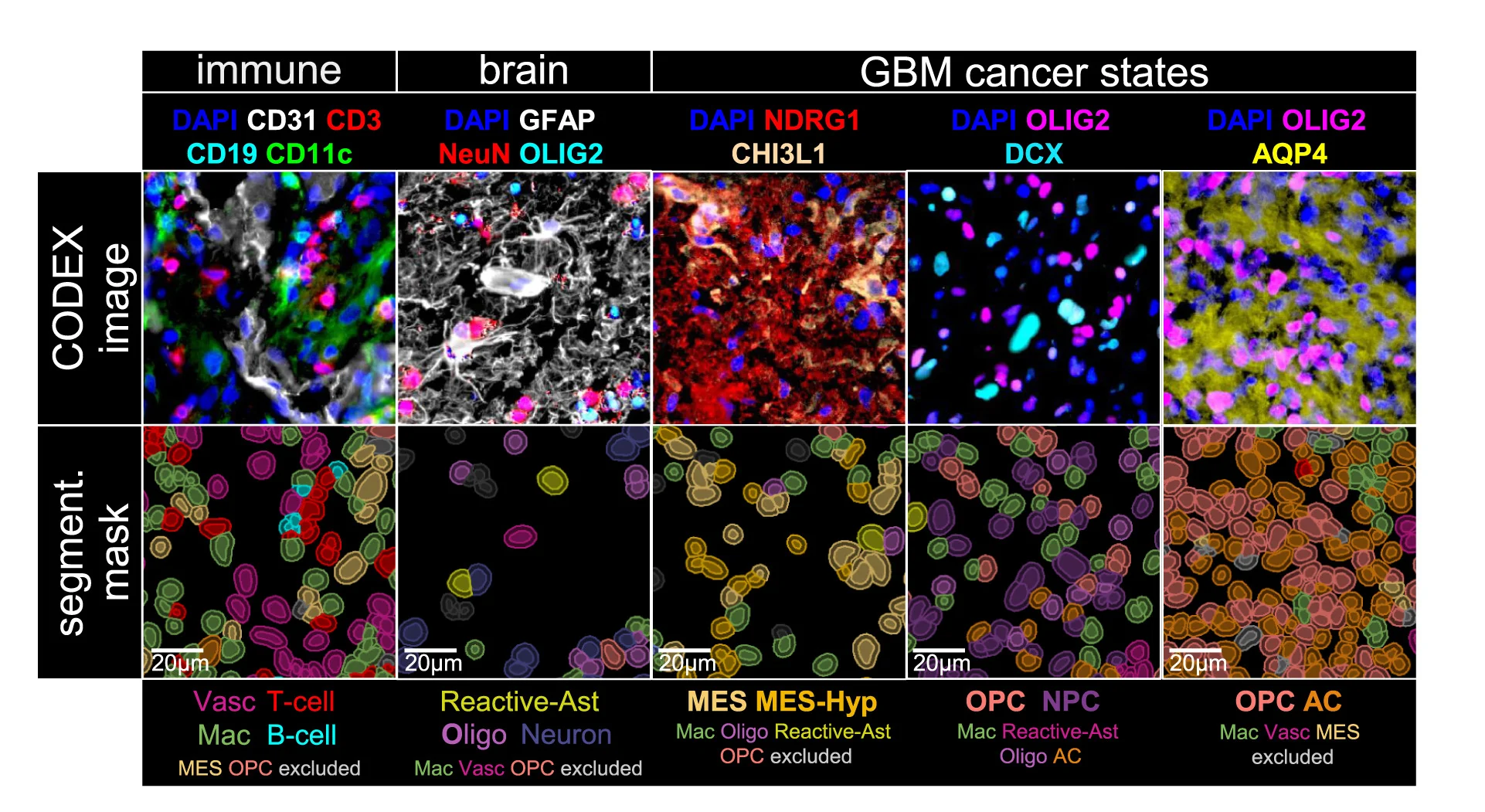 Open access visualization of Microscopy, CODEX, Staining, Nuclear Segmentation, Cell State