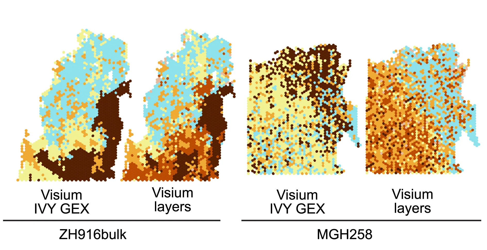 Open access visualization of Scatter Plot, Spatial Maps, Visium, Histological Features, Transcriptional Programs