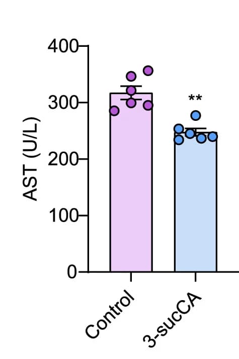 Open access visualization of Bar Plot, Error Bars, Scatter Plot, Plasma, AST Levels