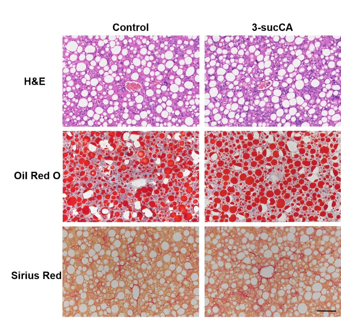 Open access visualization of Microscopy, Hematoxylin and Eosin Staining, Oil Red O Staining, Sirius Red Staining, Liver Sections