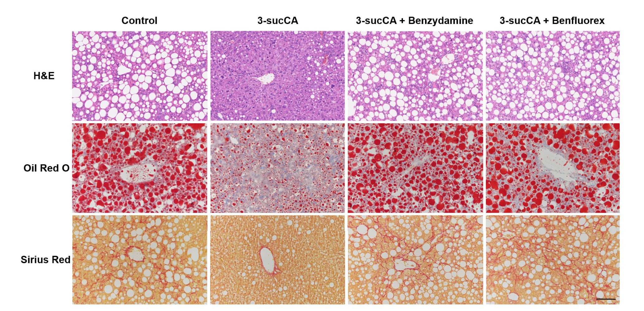 Open access visualization of Microscopy, Photo, H&E Staining, Oil Red O Staining, Sirius Red Staining