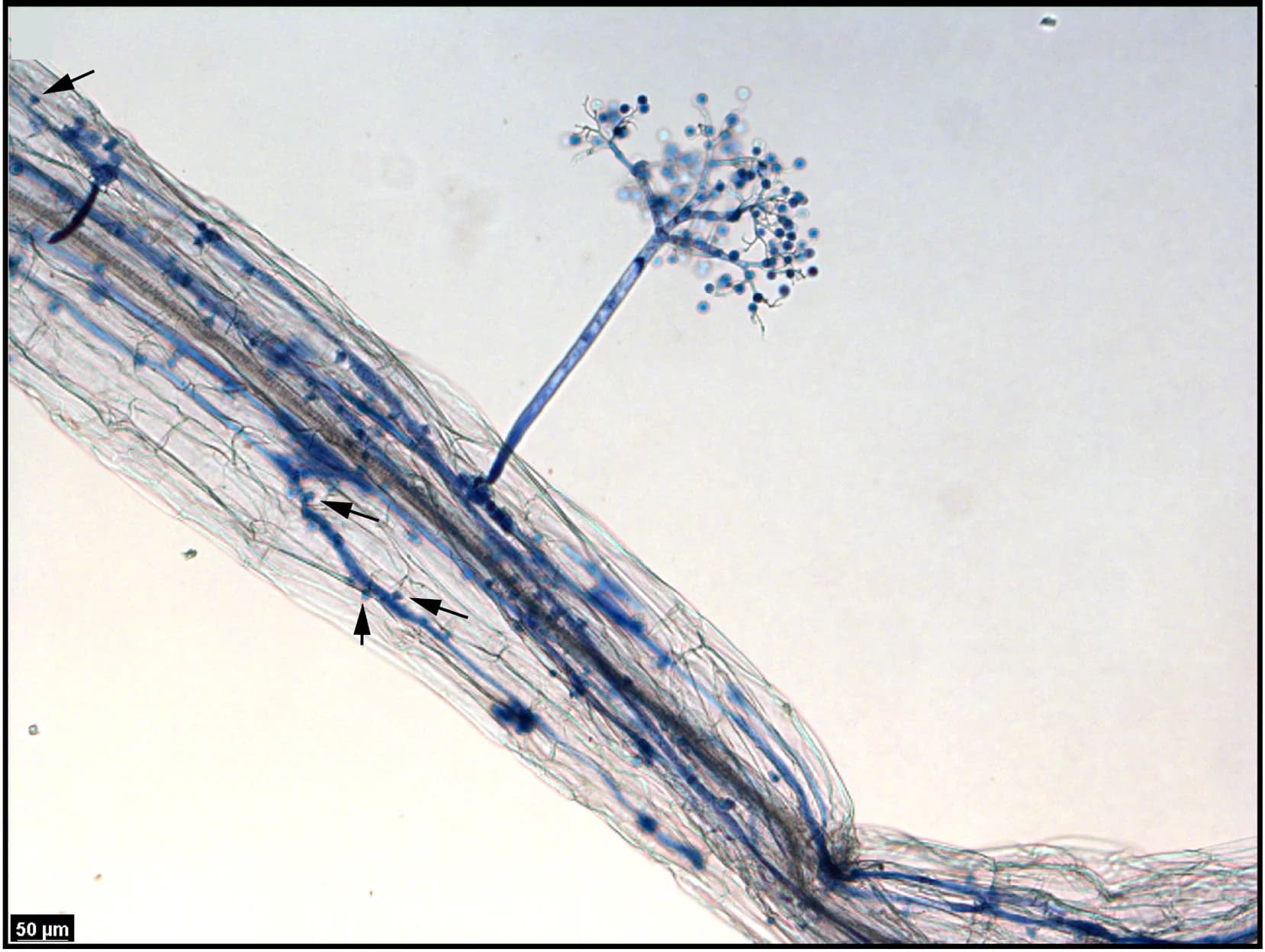 Open access visualization of Microscopy, Hyaloperonospora Arabidopsis, Arabidopsis Hypocotyl, Sporulation, Trypan Blue