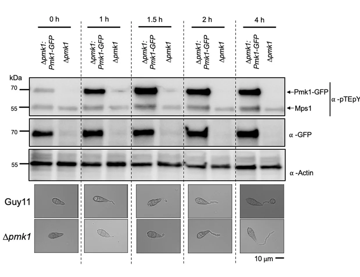 Open access visualization of Gel, Microscopy, Western Blot Analysis, Protein Extraction, Germinated Spores