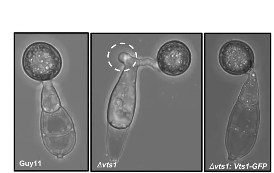 Open access visualization of Microscopy, Micrographs, Appressorium Development, Guy11, Δvts1