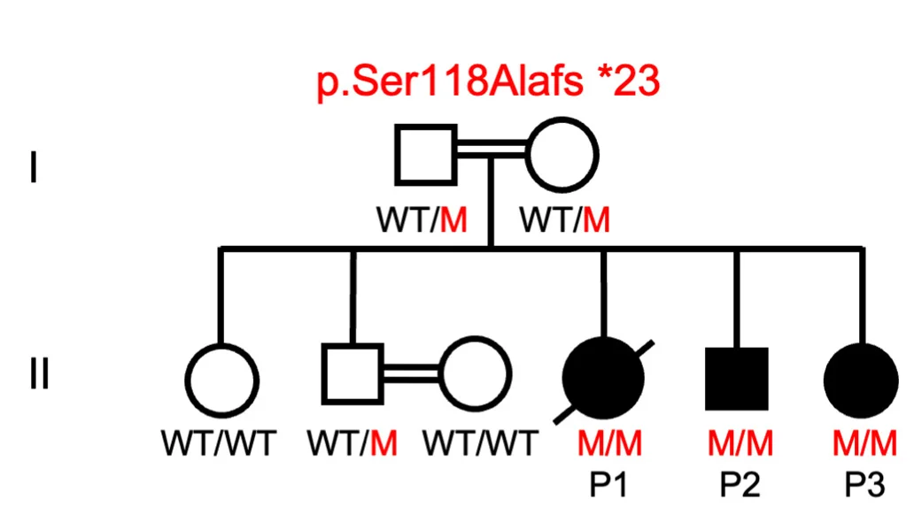 Open access visualization of Network, Pathway, Pedigree, FLT3LG Allele, FLT3L Deficiency