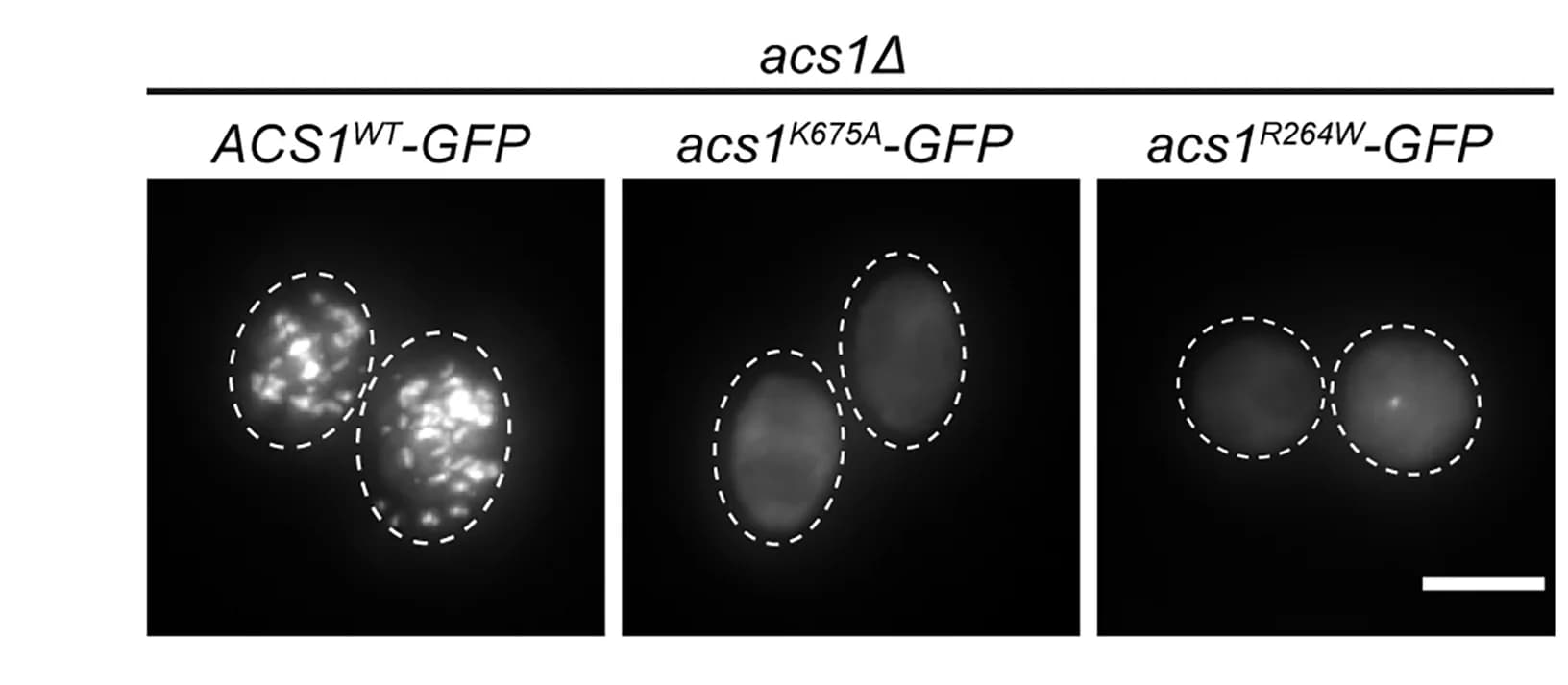 Open access visualization of Microscopy, Acs1-GFP Fluorescence, Meiotic Cells, Genotypes, Cell Contours