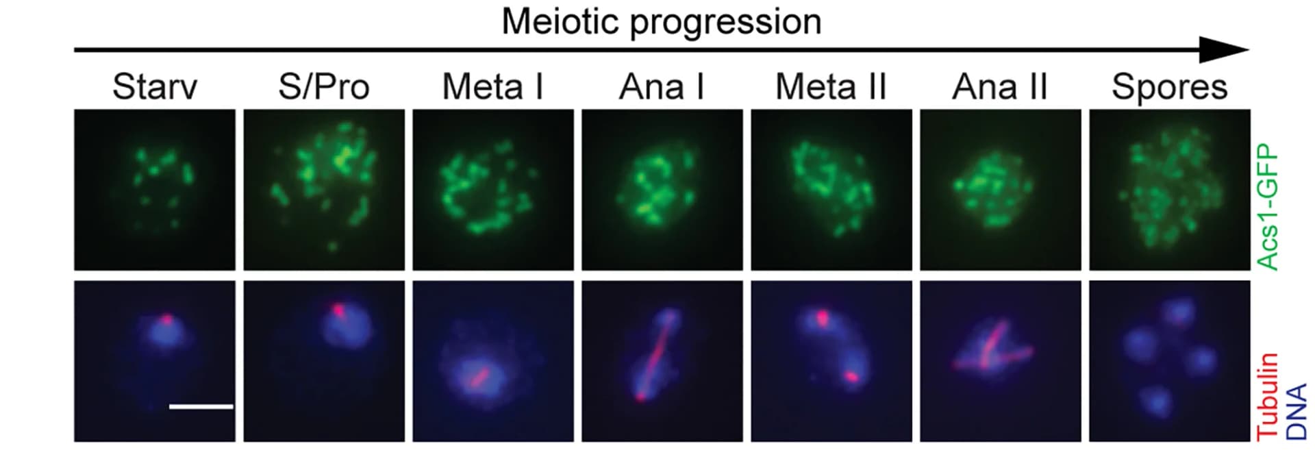 Open access visualization of Microscopy, Acs1-GFP, Immunofluorescence, GFP Antibodies, Spindle Morphology