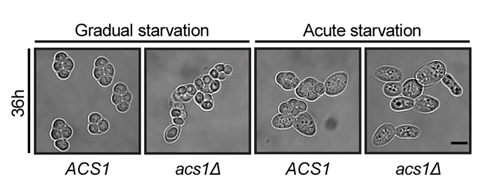 Open access visualization of Microscopy, Yeast Strains, Genotypes, Meiosis, Starvation