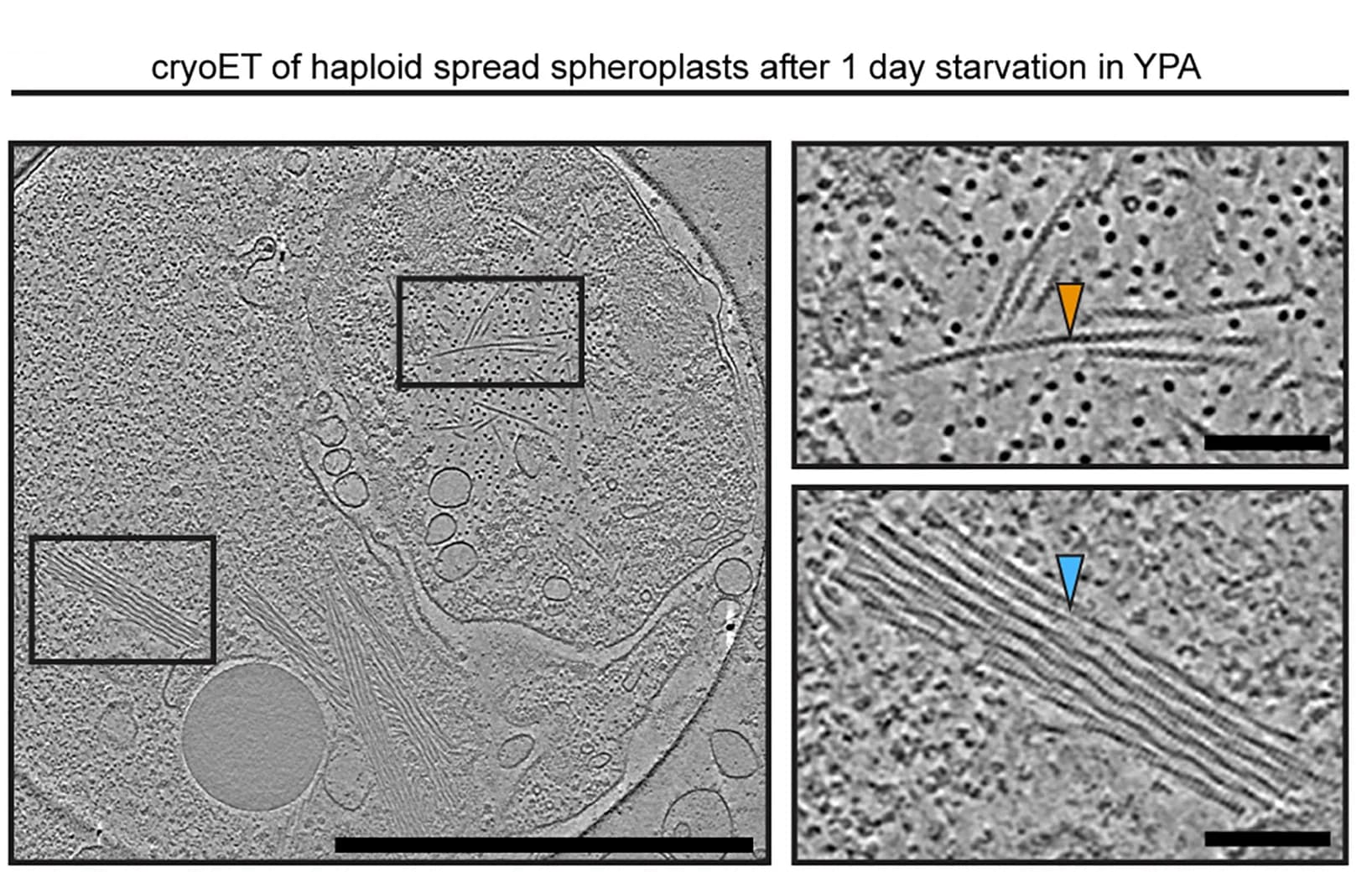 Open access visualization of Microscopy, Cryo-tomogram, Yeast Spheroplasts, Starvation, Ald4 Filaments