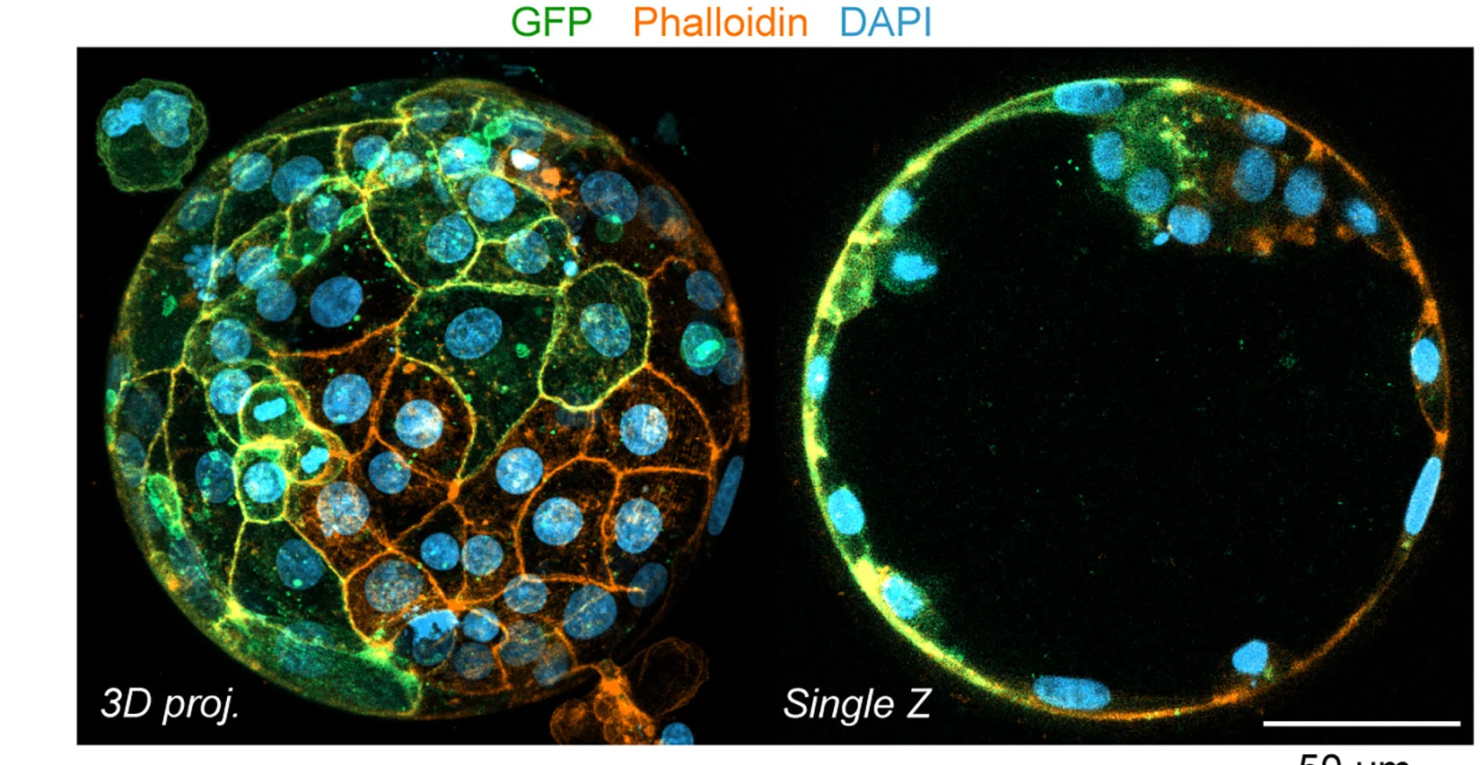 Open access visualization of Microscopy, Human Blastocyst, GFP Expression, AF647-Phalloidin, DAPI