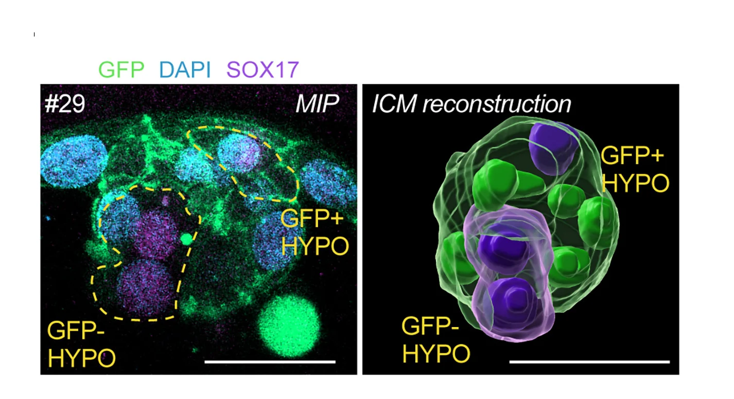Open access visualization of Microscopy, 3D Plot, Maximum Intensity Projection, Reconstruction, GFP+ ICM