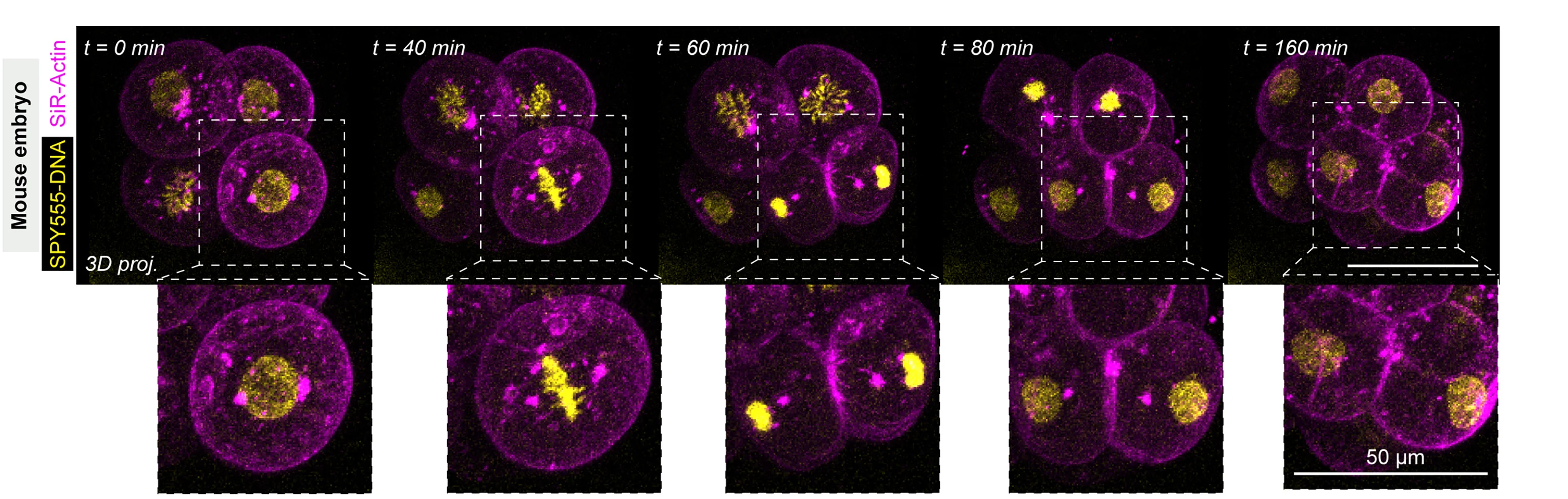 Open access visualization of Microscopy, Mouse Blastomere, SPY555-DNA, SiR-actin, Scale Bar