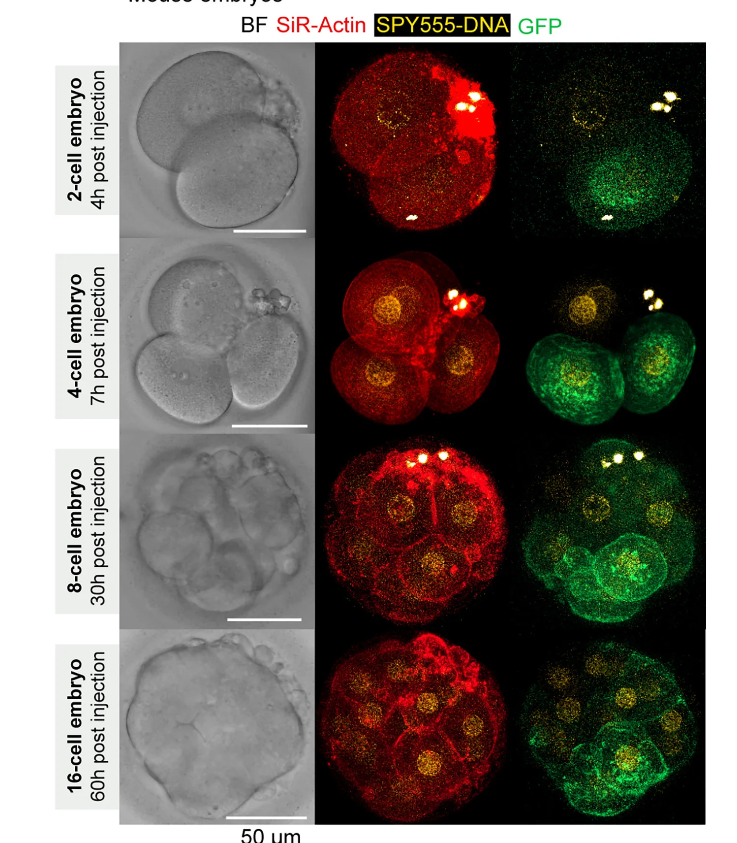 Open access visualization of Microscopy, Human Embryos, mGap43-GFP, SiR-actin, SPY555-DNA