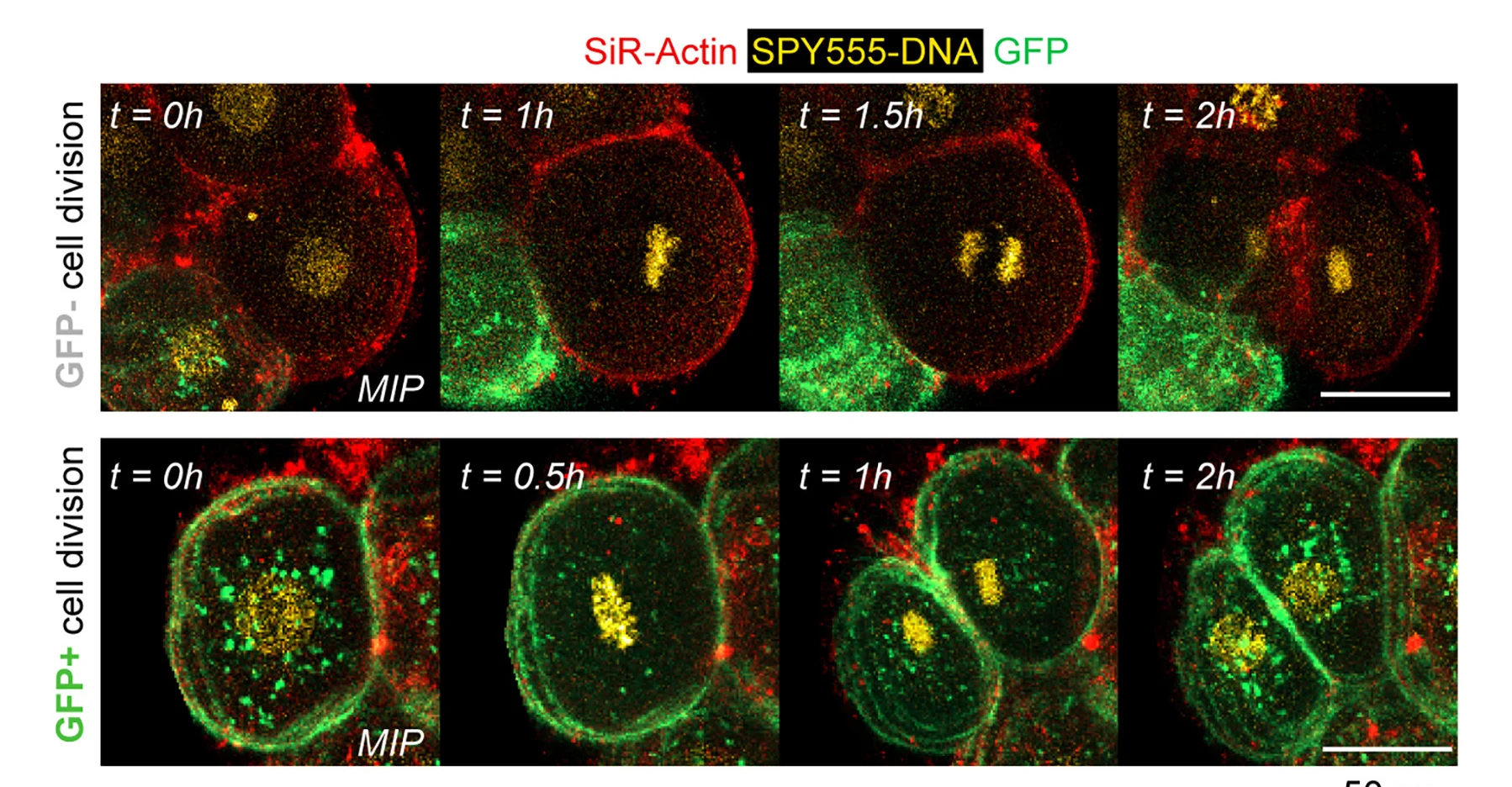 Open access visualization of Microscopy, GFP- Blastomeres, GFP+ Blastomeres, Human Blastomeres, Scale Bar