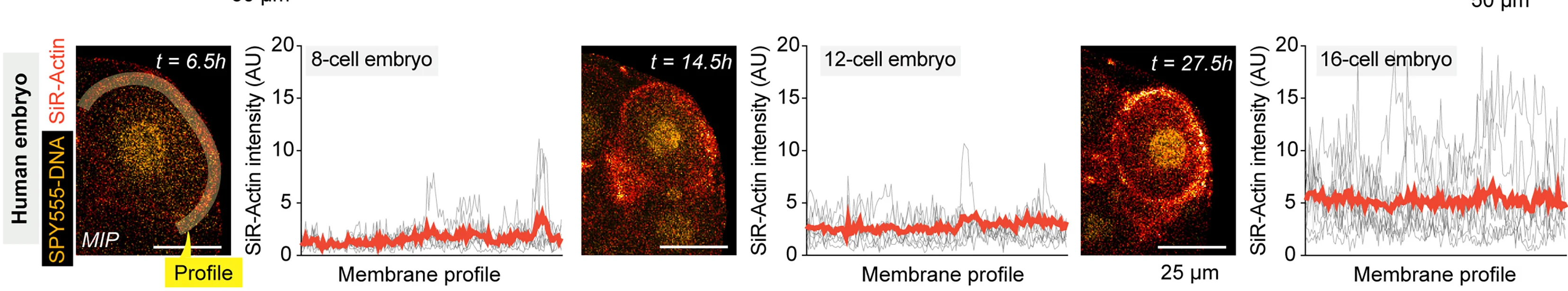 Open access visualization of Line Plot, Microscopy, Polarization Process, Human Embryos, SiR-actin