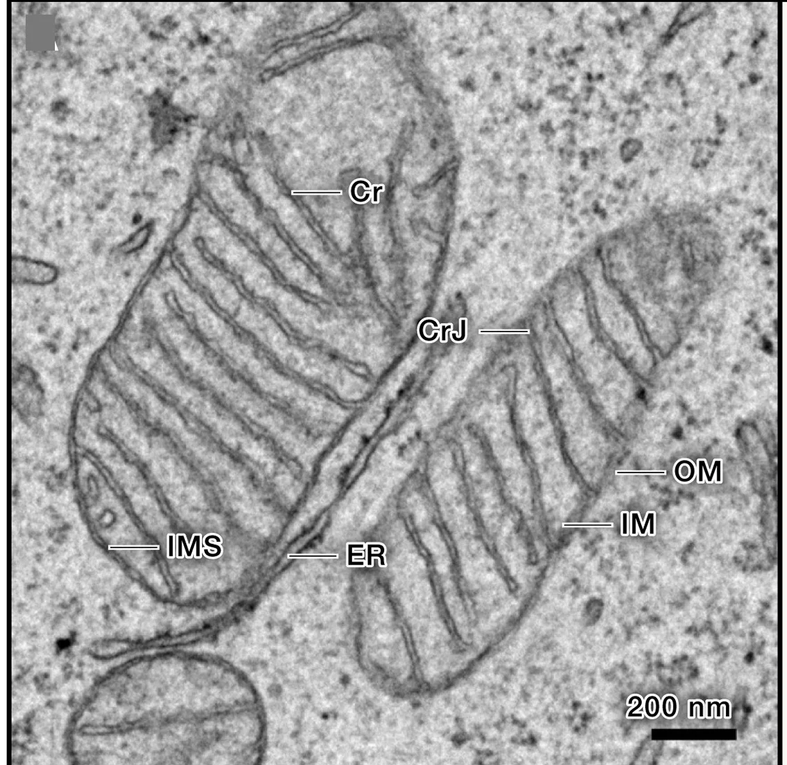 Open access visualization of Microscopy, Transmission Electron Micrograph, Kidney Cell Line, Inner Membrane, Outer Membrane