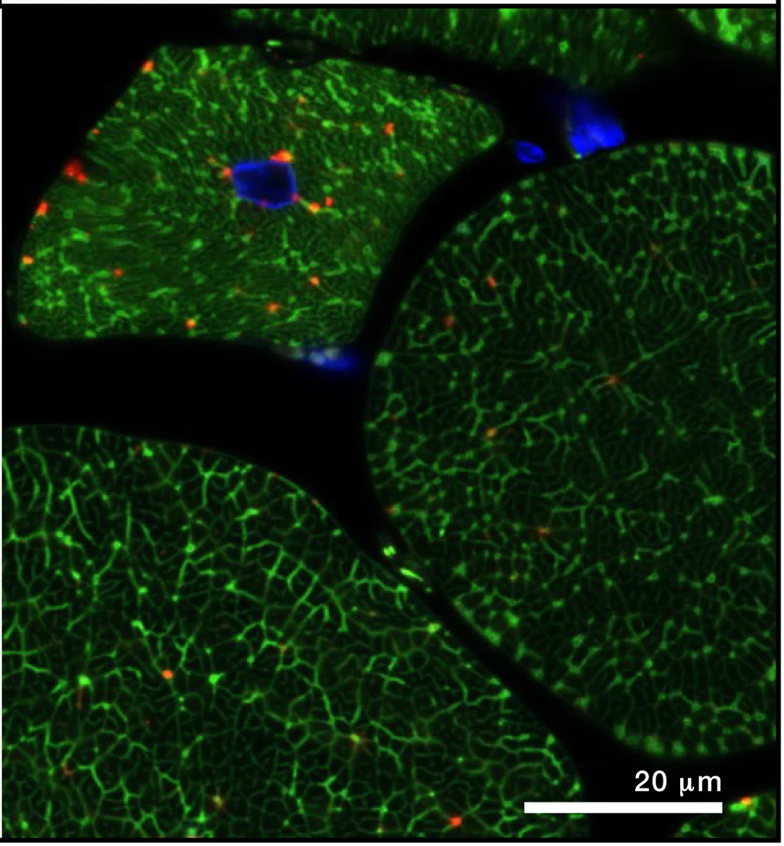 Open access visualization of Microscopy, Mitochondrial Networks, Skeletal Muscle, Mouse, Mito-QC Reporter