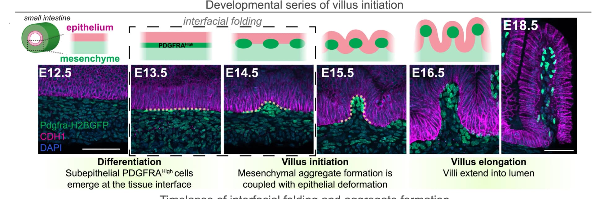 Open access visualization of Microscopy, Illustration, Optical Sections, Intestinal Villus Morphogenesis, PDGFRAH2BGFP Mice