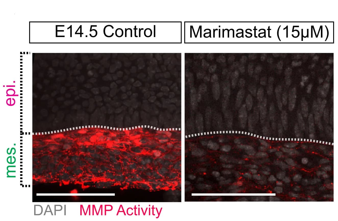 Open access visualization of Microscopy, In Situ Zymography, MMP Activity, Tissue Interface, Epithelium