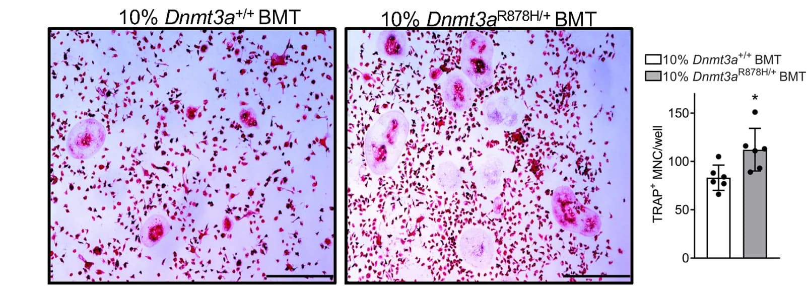 Open access visualization of Microscopy, Bar Plot, Error Bars, Osteoclastogenesis, Bone Marrow