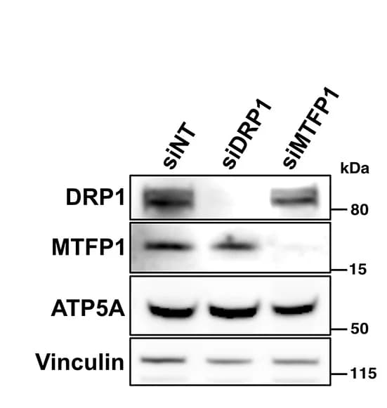 Open access visualization of Gel, Immunoblot, siRNAs
