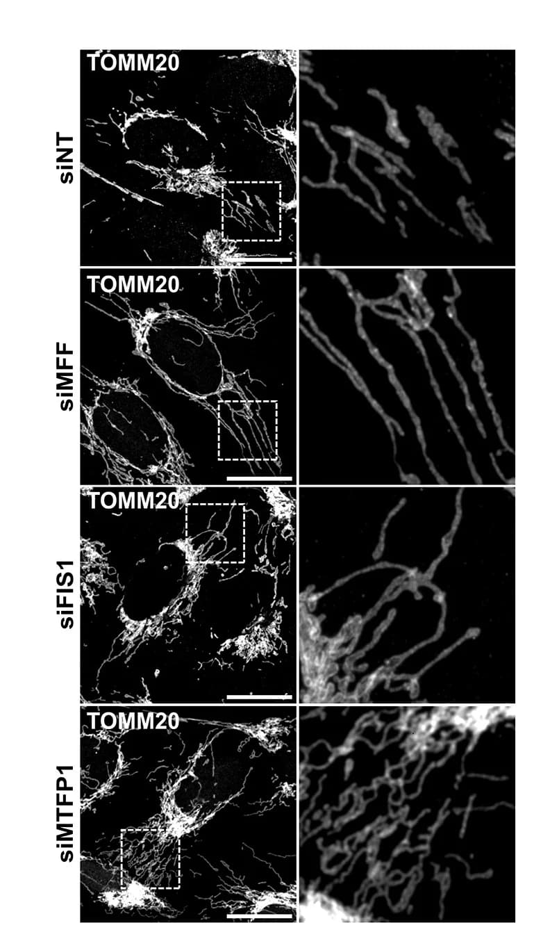 Open access visualization of Microscopy, Confocal Images, Mitochondrial Morphology, U2OS Cells, siRNAs
