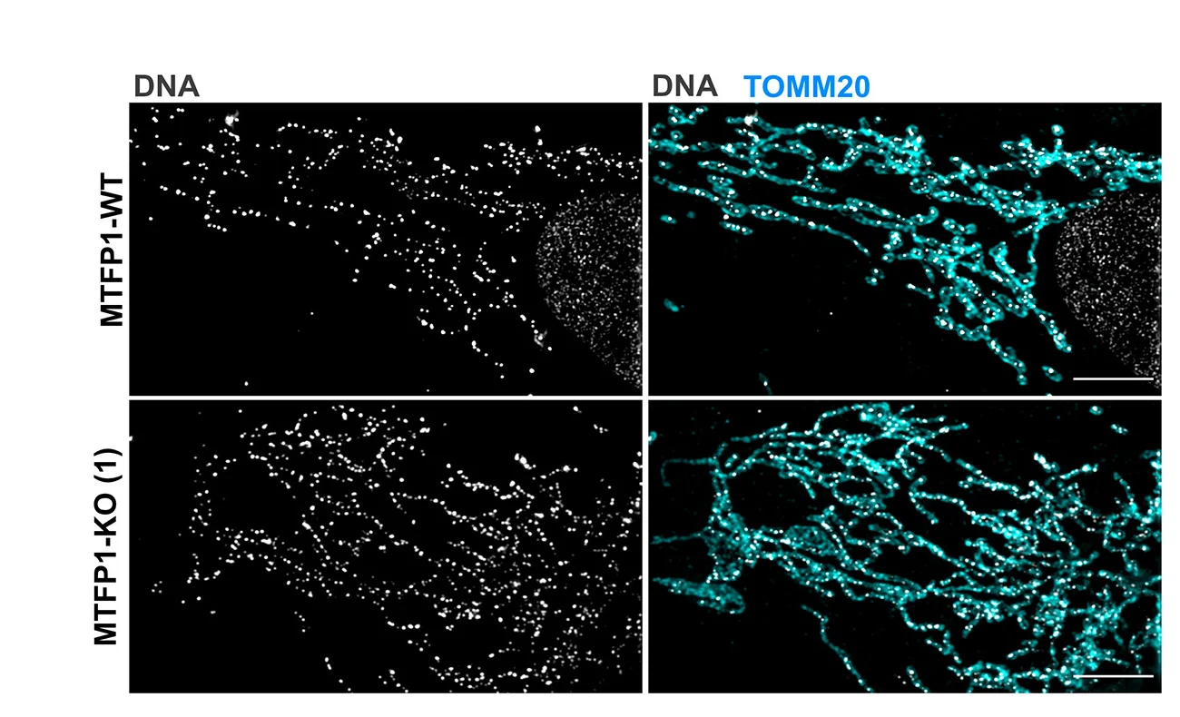 Open access visualization of Microscopy, SIM Images, Mitochondria, mtDNA, Wild Type