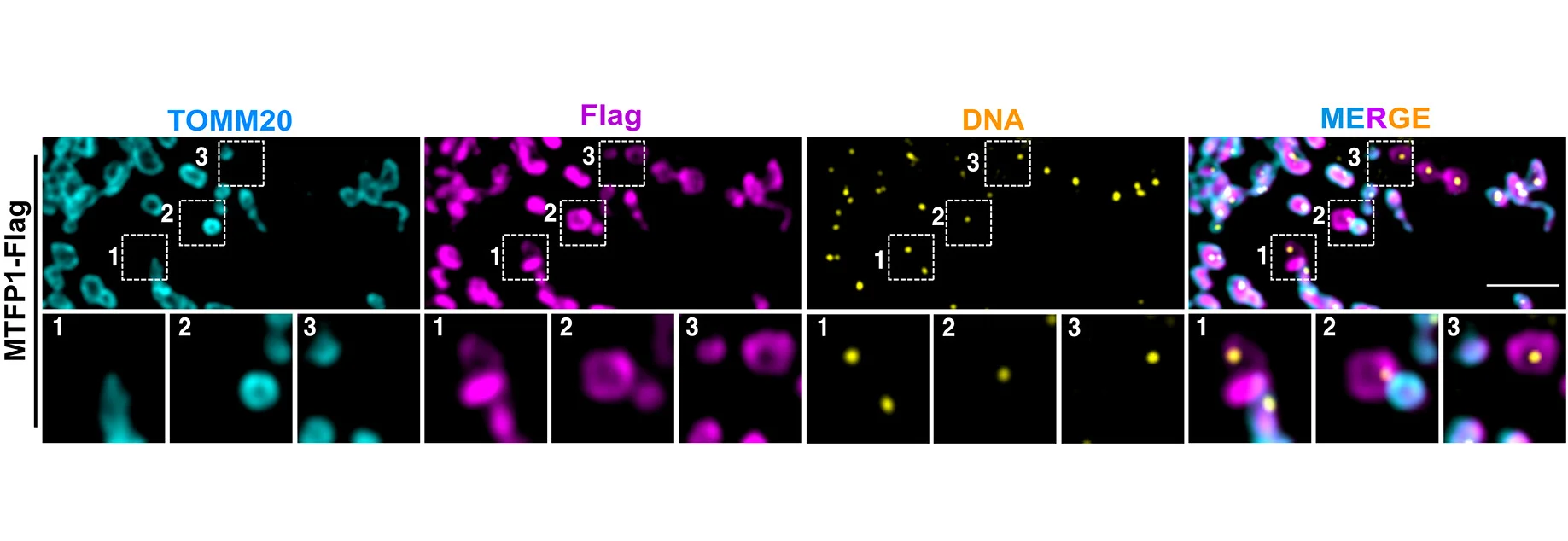 Open access visualization of Microscopy, SIM Images, MTFP1-Flag, U2OS Cells, Mitochondria