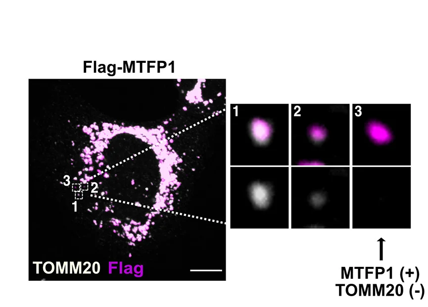 Open access visualization of Microscopy, Confocal Images, MTFP1-Flag, U2OS Cells, TOMM20