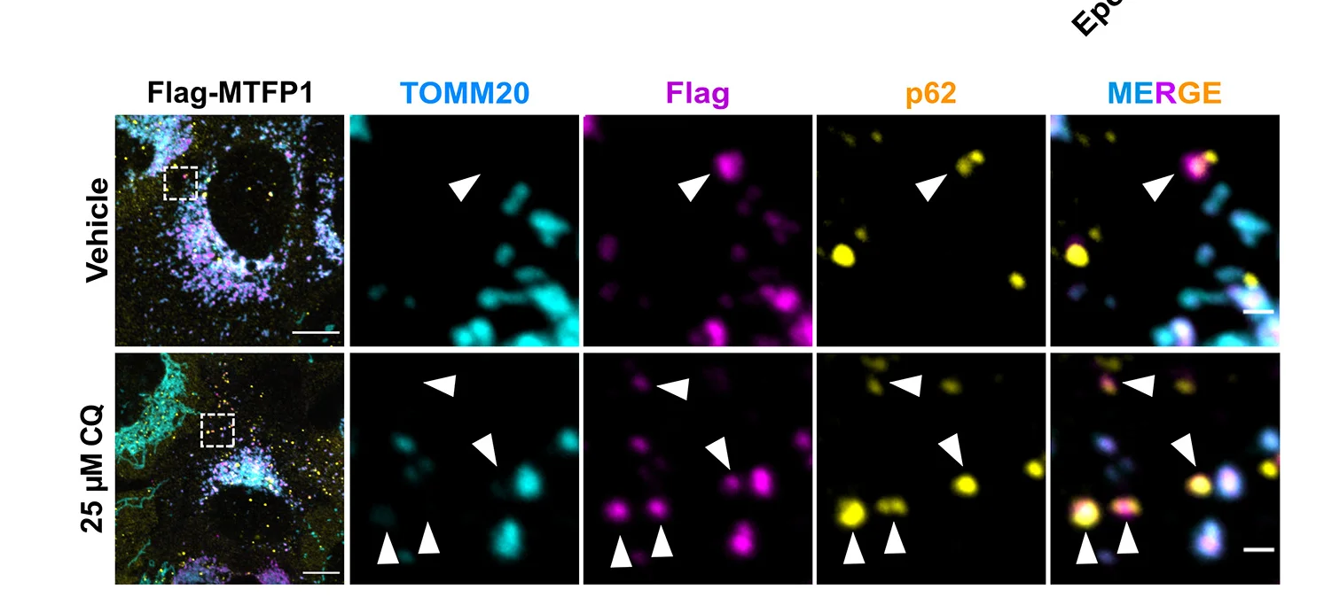 Open access visualization of Microscopy, Confocal Images, Flag-MTFP1, U2OS Cells, SMEM