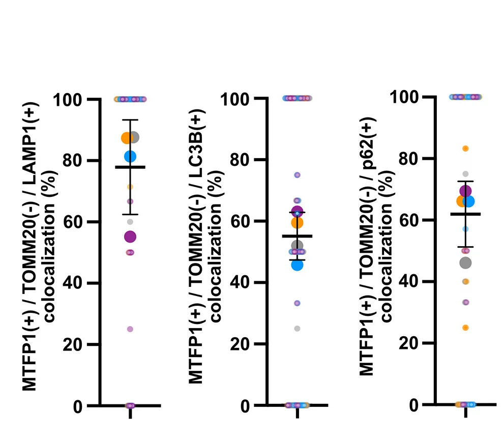 Open access visualization of Scatter Plot, Error Bars, Colocalization Analysis, SMEM, Autolysosomal Markers