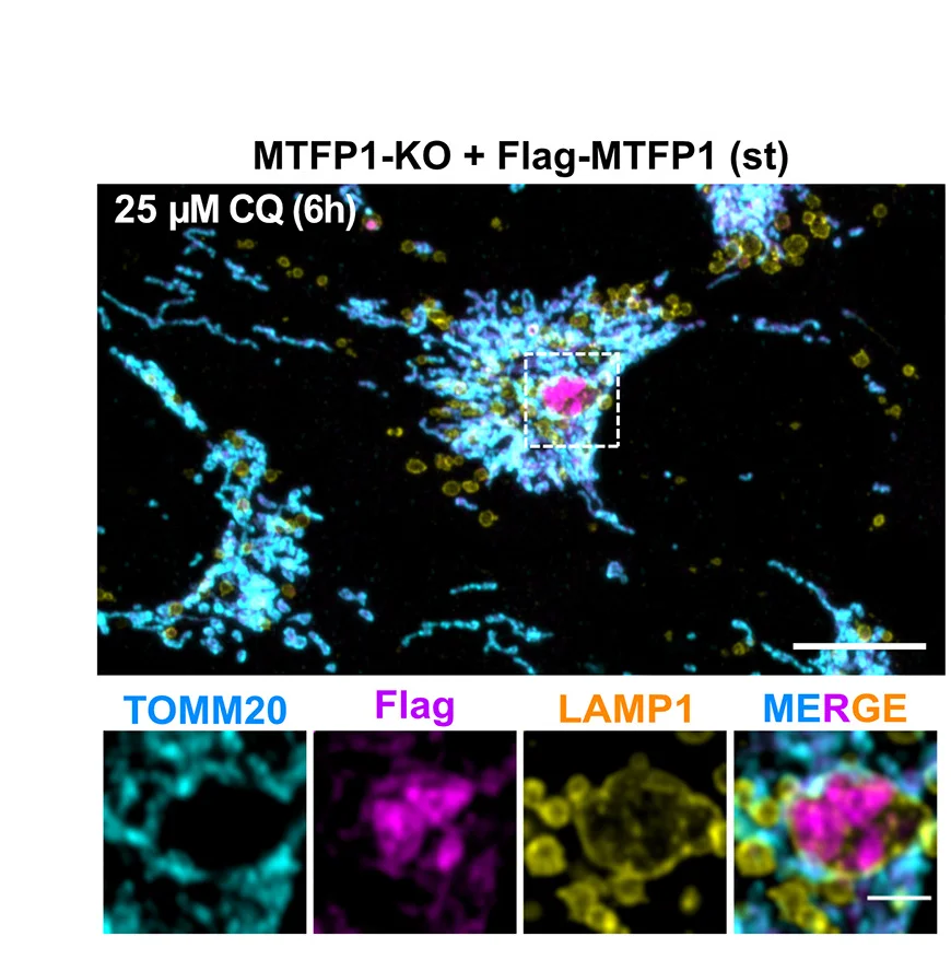 Open access visualization of Microscopy, Confocal Image, MTFP1-KO U2OS Cells, Flag-MTFP1, CQ