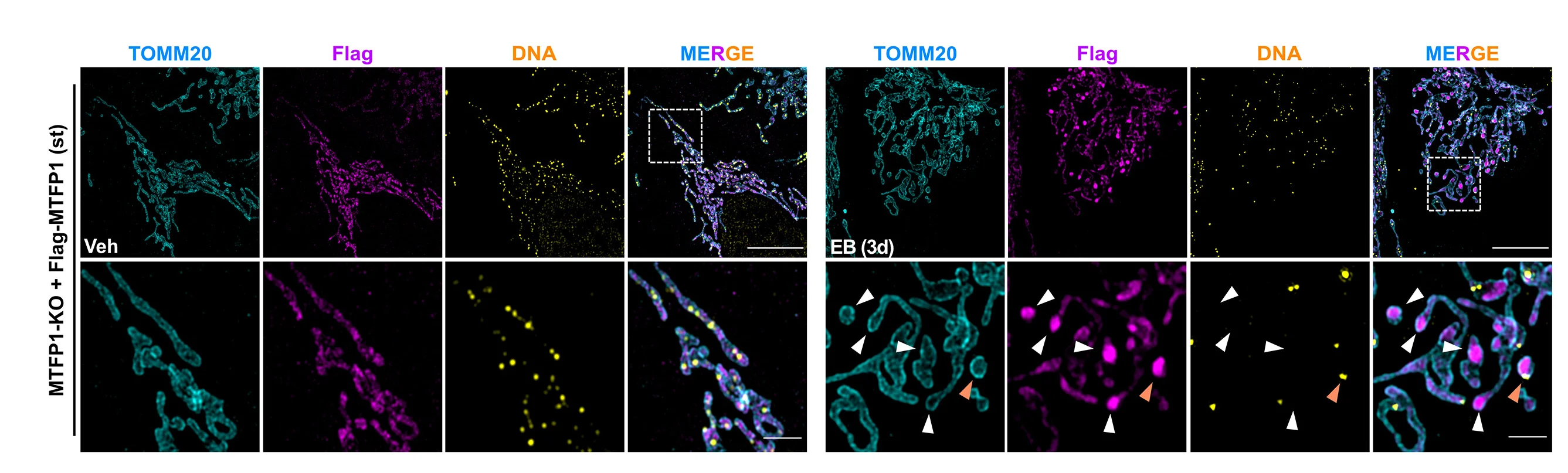 Open access visualization of Microscopy, SIM Images, MTFP1-KO Cells, Flag-MTFP1, DNA