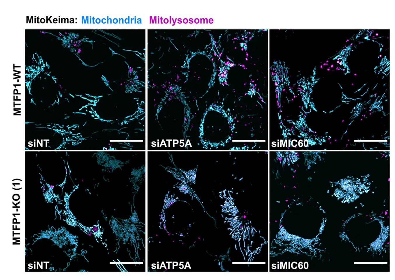Open access visualization of Microscopy, Confocal Images, Mitophagy Reporter, siRNAs, U2OS Cells