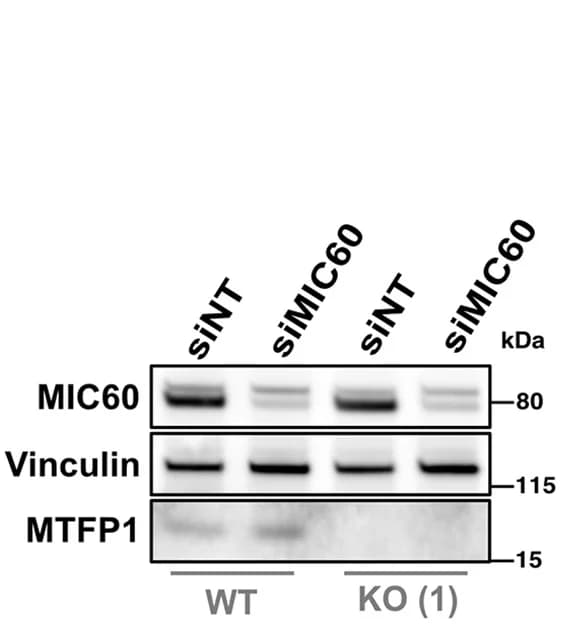 Open access visualization of Gel, Immunoblot, siRNAs