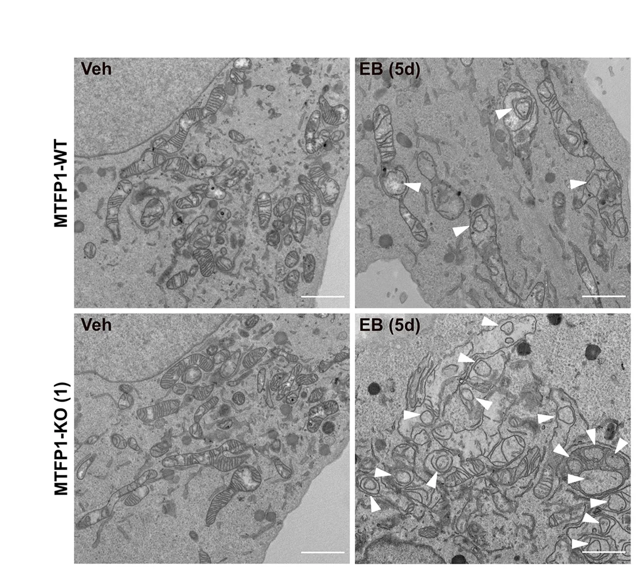Open access visualization of Microscopy, TEM Images, IMM Subdomains, U2OS Cells, EB Treatment