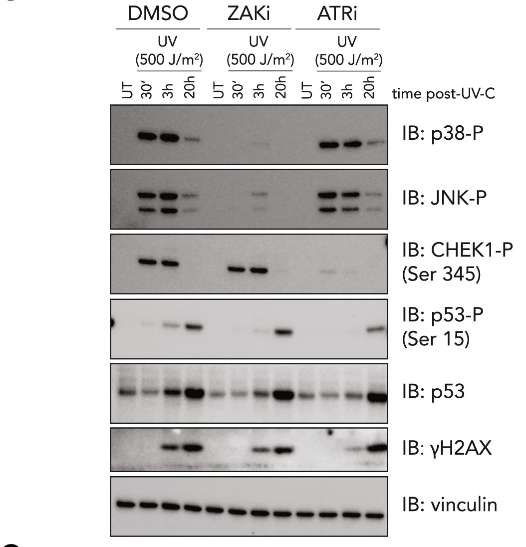 Open access visualization of Gel, Immunoblots, MCF10a WT Cells, DMSO, ZAKi